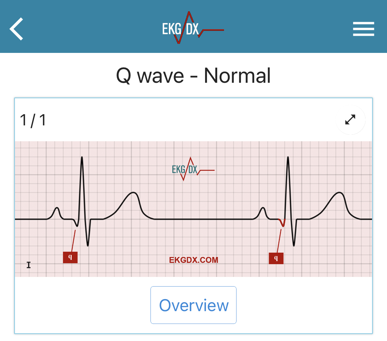 EKGDX - The new era of EKG learning